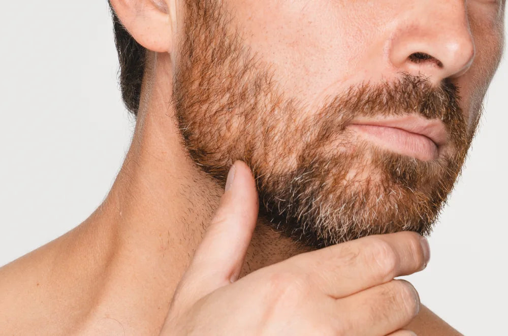 Picor de barba